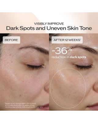 Benefiance Dark Spot & Wrinkle Smoothing Serum 1 oz.