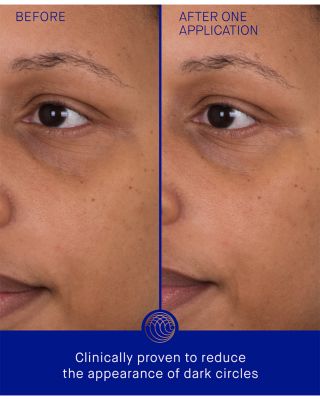 The Eye Patches, Pack of 3