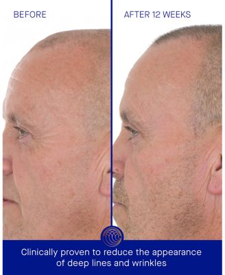 The Retinol Serum 1 oz.