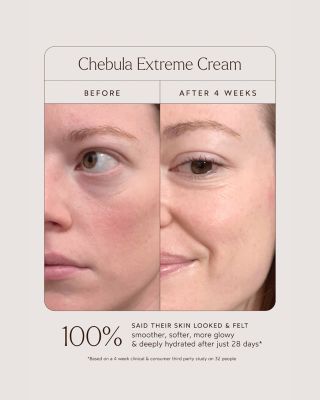 Chebula Extreme Cream 1.7 oz.