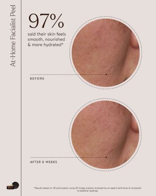 At Home Facialist Peel 1 oz.
