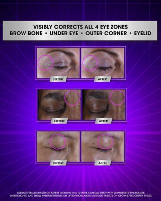 Super Multi-Corrective Eye Zone Treatment 0.9 oz.