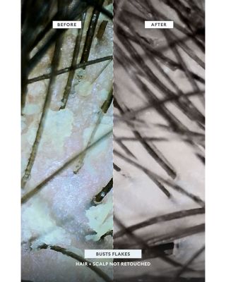 Scalp Revival MegaStrength+ Dandruff Relief Shampoo 8.4 oz.