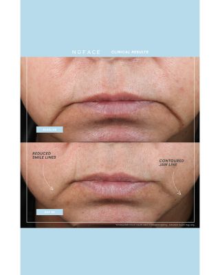 Trinity+ Facial Toning Device & Primer