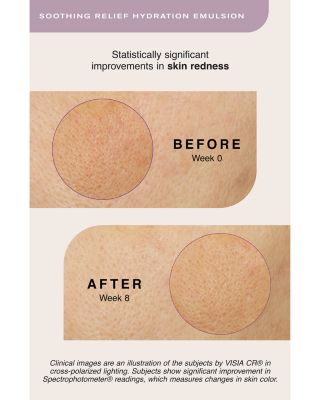 Soothing Relief Hydration Emulsion 2.5 oz.