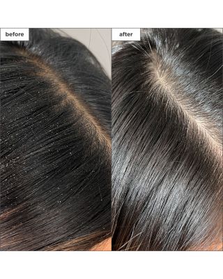 Scalp Revival Charcoal + Tea Tree Buildup Detox Spray 4 oz.