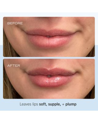 Ultra Repair Lip Balm