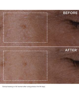 Super Restorative Luxury Anti Aging Gift Set ($366 value)