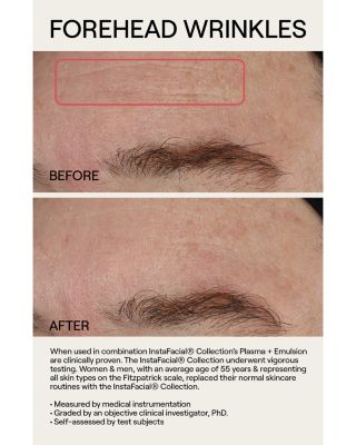 InstaFacial&reg; Plasma Bioactive Growth Factor Serum 1 oz.