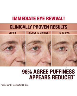 Immediate Eye Revival Patches