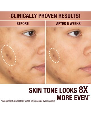 Dark Spot Correcting Radiance Recovery Serum 0.34 oz.