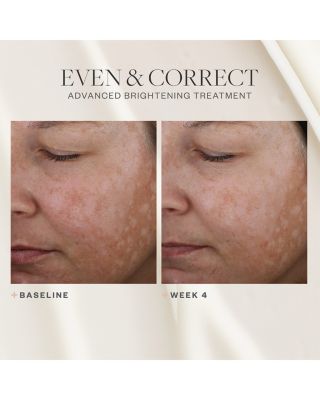 Even & Correct Advanced Brightening Treatment 2 oz.