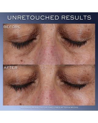 Advanced G&eacute;nifique Yeux Eye Cream