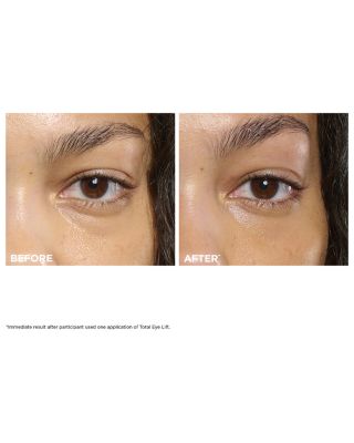 Total Eye Lift Eye Cream 0.5 oz.