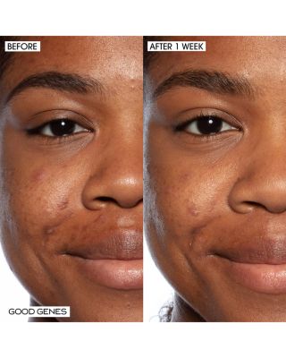 Instant Gratification Set ($115 value)