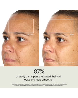 TheraFace Mask Glo – Clinically Proven LED Skincare Mask