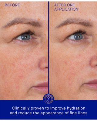 The Eye Patches, Pack of 3