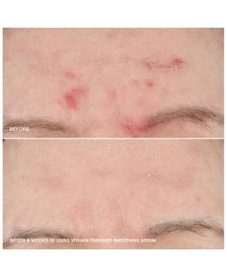 Vitamin Enriched Smoothing Serum with Niacinamide 1.01 oz.