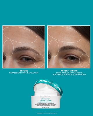 Full Size Peptide Skinjection Solutions Face & Eye Skincare Gift Set