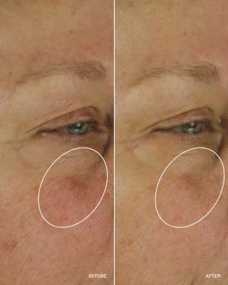 NAD+ Cell Energizing Treatment 1.7 oz.