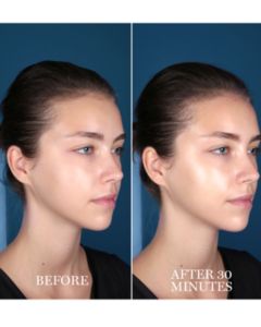 Lancôme - Advanced Génifique Hydrogel Melting Sheet Mask, Single Mask