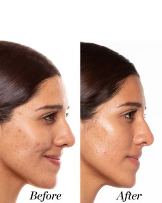 A+ High-Dose Retinoid Serum 1 oz.