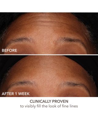 DermInfusions Fill + Repair Serum 1 oz.