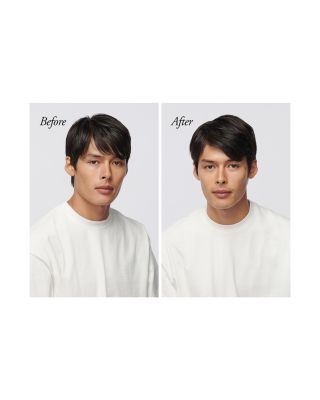 Serene Scalp Oil Control Shampoo 8.5 oz.