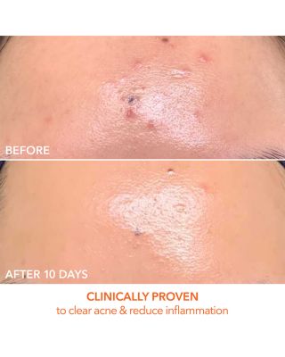 DRx SpectraLite™ Faceware Pro