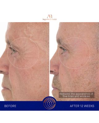 The Retinol Serum 0.5 oz.