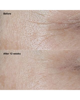 Smart Clinical Repair Broad Spectrum SPF 30 Wrinkle Correcting Face Cream 2.5 oz.