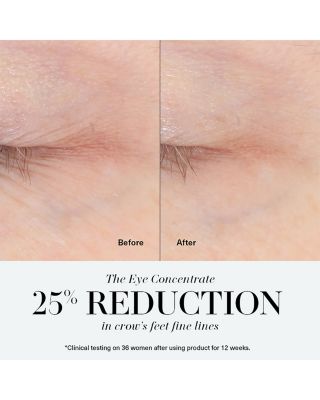 The Eye Concentrate 0.5 oz.