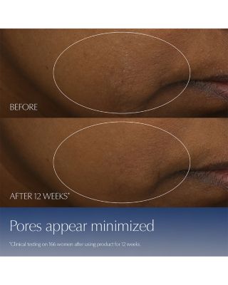 Advanced Night Repair Synchronized Multi-Recovery Complex Serum 3.9 oz.