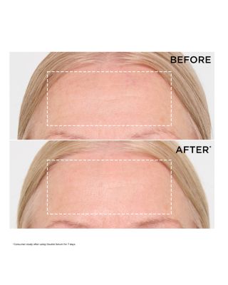 Super Restorative Luxury Anti Aging Gift Set ($366 value)