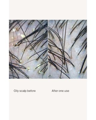 Scalp Care Exfoliator 3.4 oz.