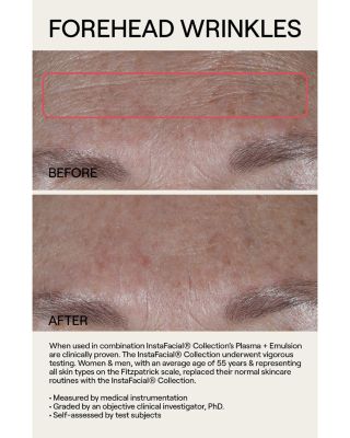 InstaFacial&reg; Plasma Bioactive Growth Factor Serum 1 oz.