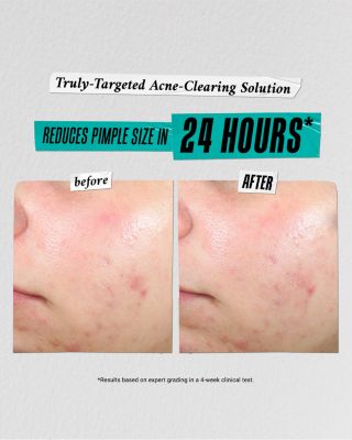 Kiehl's Since 1851 Skincare Solutions Gift Set ($87 value)