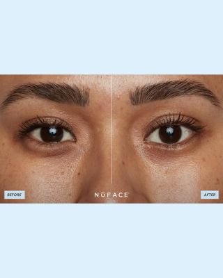 Trinity All In One Kit ($785 value)