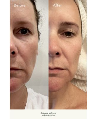 Rosehip Intense Recovery Eye Serum 0.5 oz.