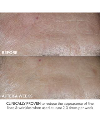 Advanced Retinol + Ferulic Perfectly Dosed Retinol Peel (Universal 0.2% Pure Retinol), Set of 8