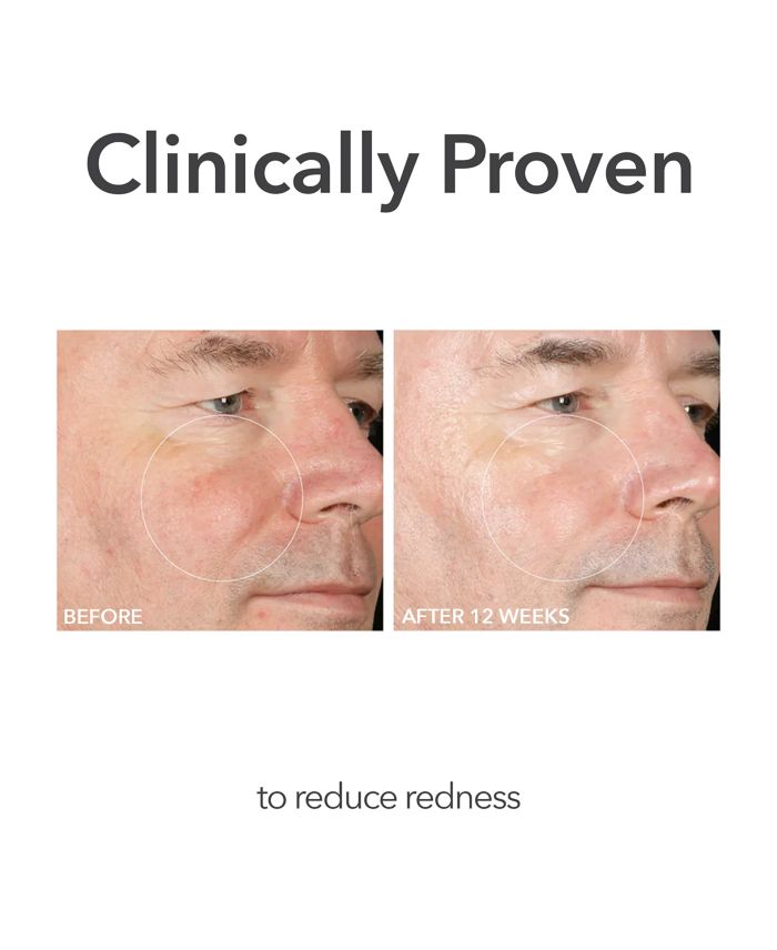 Alpha Beta® Extra Strength Daily Peel