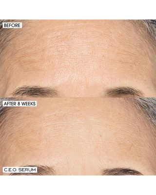 C.E.O. Home + Away Set ($135 value)