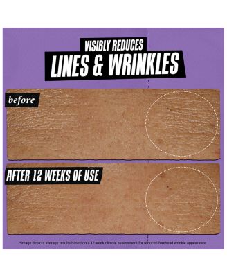 Retinol Skin-Renewing Daily Micro-Dose Serum 1.7 oz.