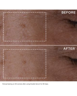 Face & Eyes Skincare Gift Set ($190 value)