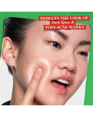 Clearly Corrective Dark Spot Solution Gift Set