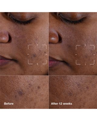 Brightening Routine Mini Even Better Skincare Gift Set ($51 value)