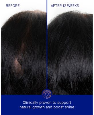 The Scalp Treatment 1 oz.