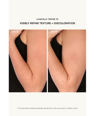 Resurfacing Body Compound 6.7 oz.