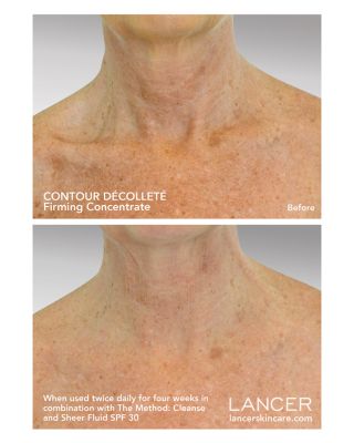 Contour D&amp;eacute;collet&amp;eacute; Firming Concentrate 1.7 oz.