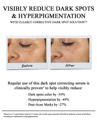 Clearly Corrective™ Dark Spot Solution 1.7 oz.